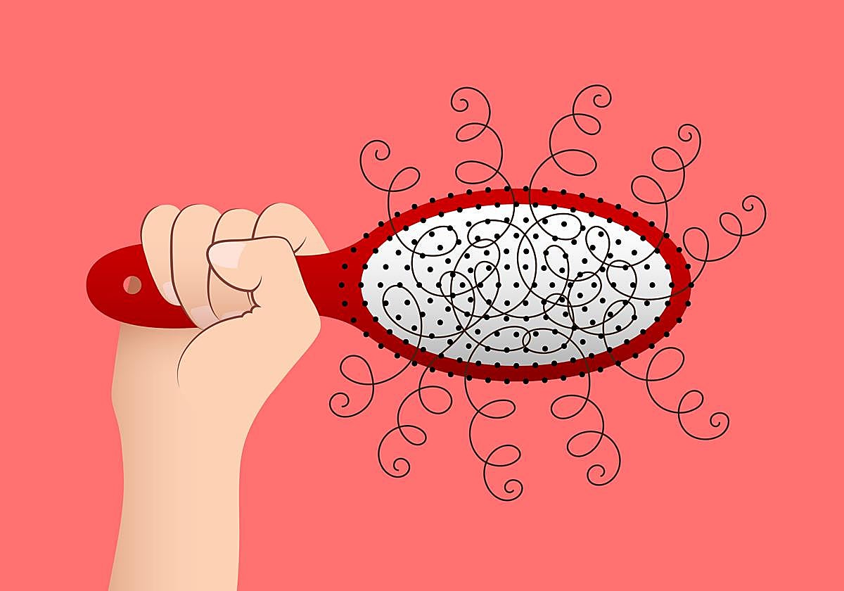 De medicinas a tratamientos todos los remedios si se te cae el pelo Hoy